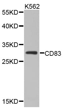 Polyclonal Rabbit anti-Human CD83 Antibody (IHC, WB)