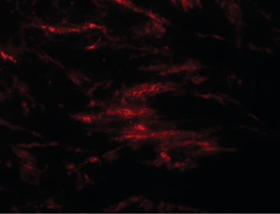 SLC39A2 / ZIP2 Antibody