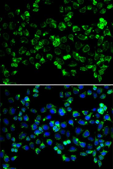 Polyclonal Rabbit anti-Human PINK1 Antibody (IHC, IF, WB)