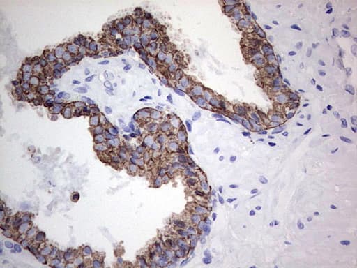 Acidic Cytokeratin Antibody (clone 8A3)