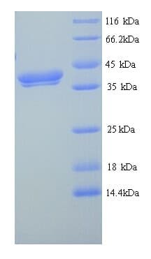 Mouse FAM132B Protein (Recombinant His)