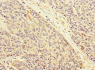ATRN / Attractin Antibody