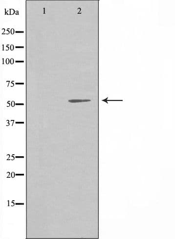 PPP2R5A Antibody