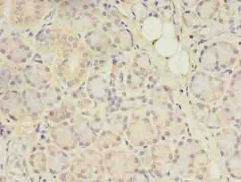 CENTB1 / ACAP1 Antibody