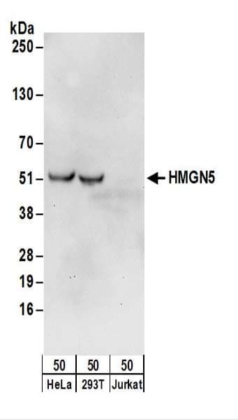 Polyclonal Rabbit anti-Human NSBP1 / HMGN5 Antibody (aa232-282, WB)