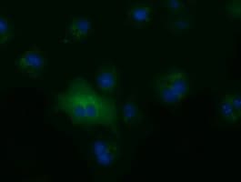 Monoclonal Mouse anti-Human ALDH1L1 Antibody (clone OTI7B7, IF, WB)