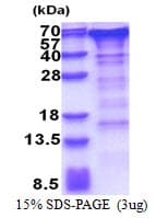Human GOLM1 / GP73 / GOLPH2 Protein (Recombinant His)
