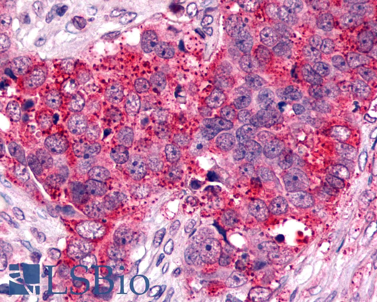 IHC-plus™ Polyclonal Rabbit anti-Human CXCR6 Antibody (Cytoplasmic Domain, IHC)