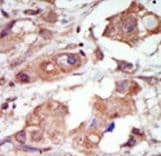 MAP3K10 / MLK2 Antibody (aa628-659)