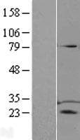 D52 / TPD52 Protein (Over-Expression Lysate Myc-DDK (Flag))