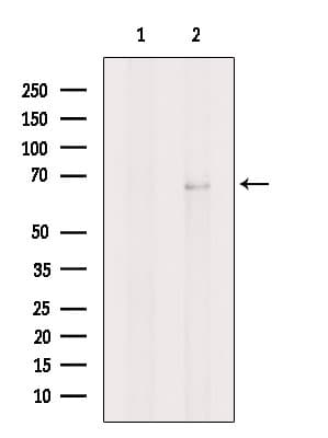 NR4A2 / NURR1 Antibody