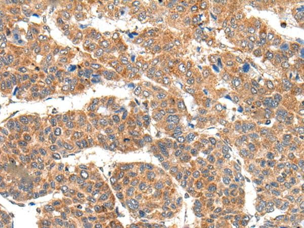 RPL14 / Ribosomal Protein L14 Antibody