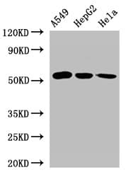 Polyclonal Rabbit anti-Human ONECUT2 / OC2 Antibody (IHC, WB)