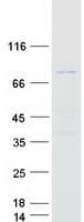 Human ZNF238 Protein (Recombinant Myc-DDK (Flag))