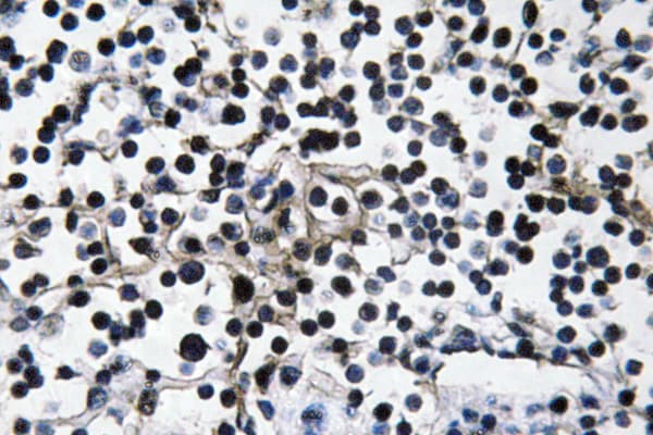 PIK3CA / PI3K Alpha Antibody (aa470-519)