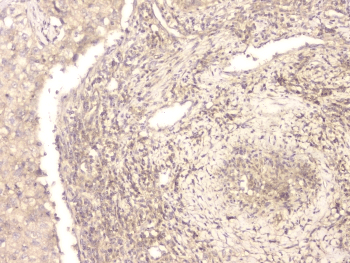 Polyclonal Rabbit anti-Human BMP15 Antibody (IHC, WB)