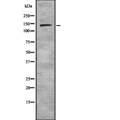 SF3B1 Antibody