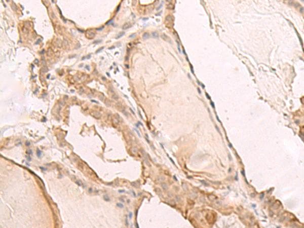 PBXIP1 / HPIP Antibody