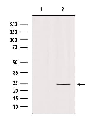 RAB6B Antibody