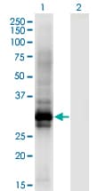 HOXB6 Antibody (clone 8E3)