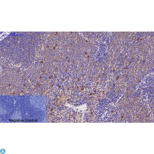TUBE1 / Tubulin Epsilon Antibody