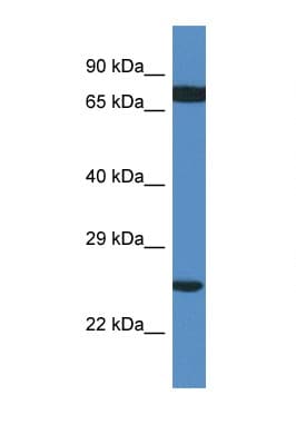 RPL7A / Ribosomal Protein L7a Antibody (C-Terminus)