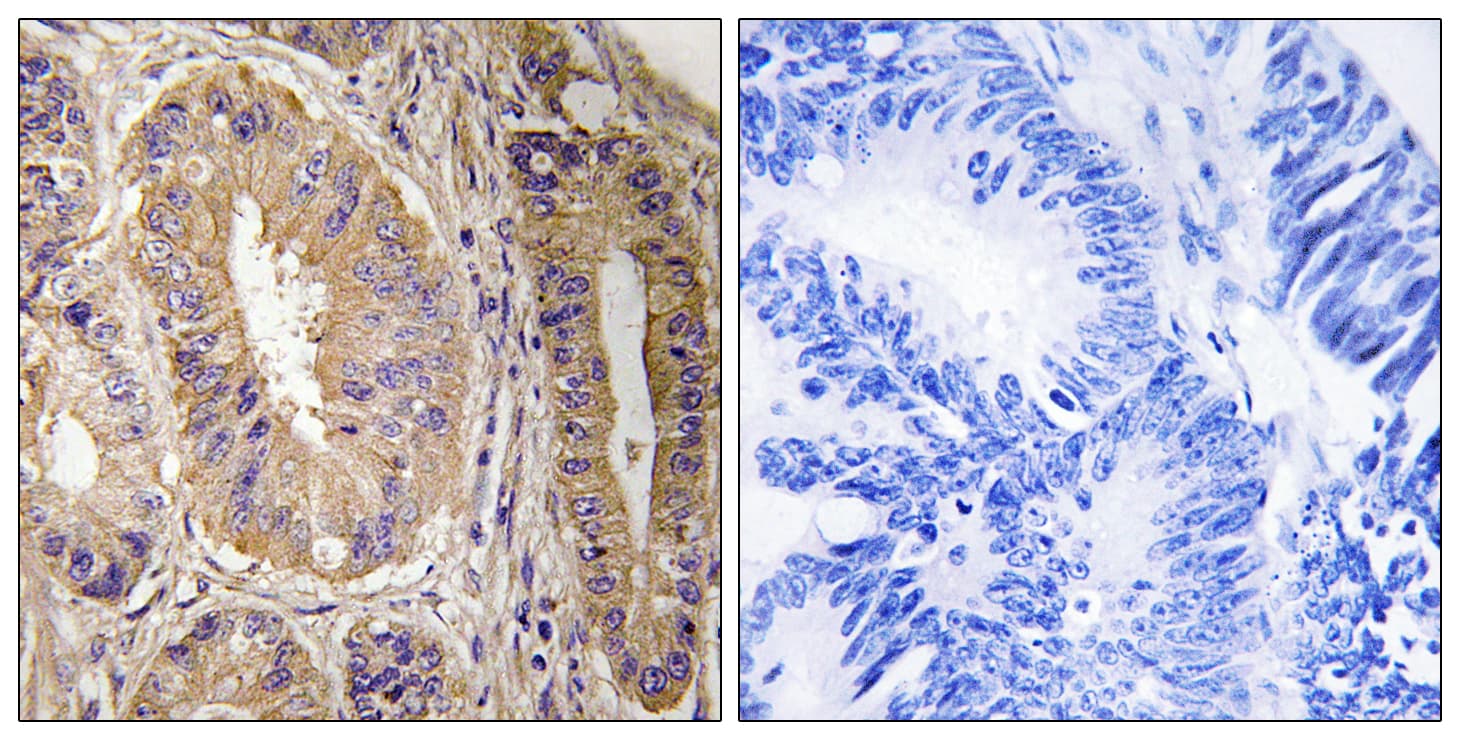 Polyclonal Rabbit anti-Human FAK / Focal Adhesion Kinase Antibody (aa809-858, IHC, WB)