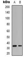 CDK4 Antibody (N-Terminus)