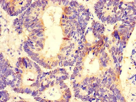 Polyclonal Rabbit anti-Human DDX6 Antibody (IHC, IF, WB)