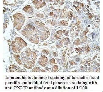 PNLIP / PL / Pancreatic Lipase Antibody (aa60-269)