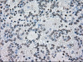 BRAF / B-Raf Antibody (clone OTI4A5)