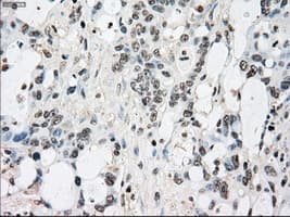 Monoclonal Mouse anti-Human BRAF / B-Raf Antibody (clone OTI1G6, IHC, WB)