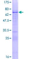 Human ALX1 Protein (Recombinant GST)