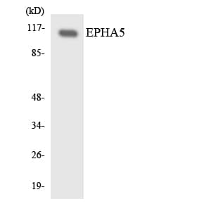 EPHA5 / EPH Receptor A5 Antibody (aa466-515)
