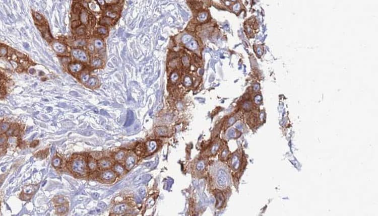 TAS2R38 Antibody