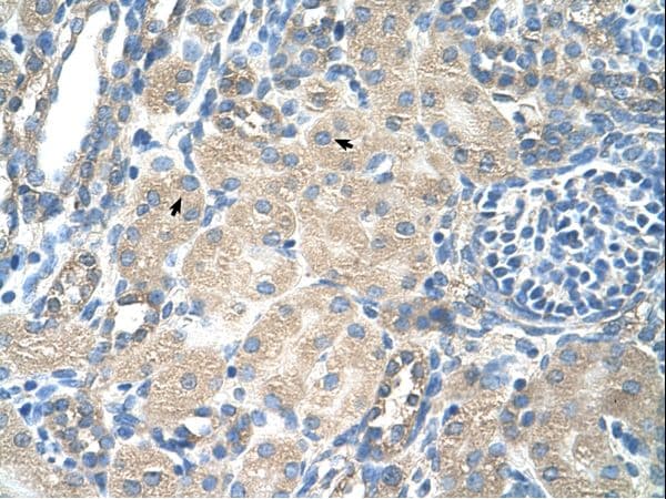Polyclonal Rabbit anti-Human SLC13A3 Antibody (aa256-305, IHC, WB)