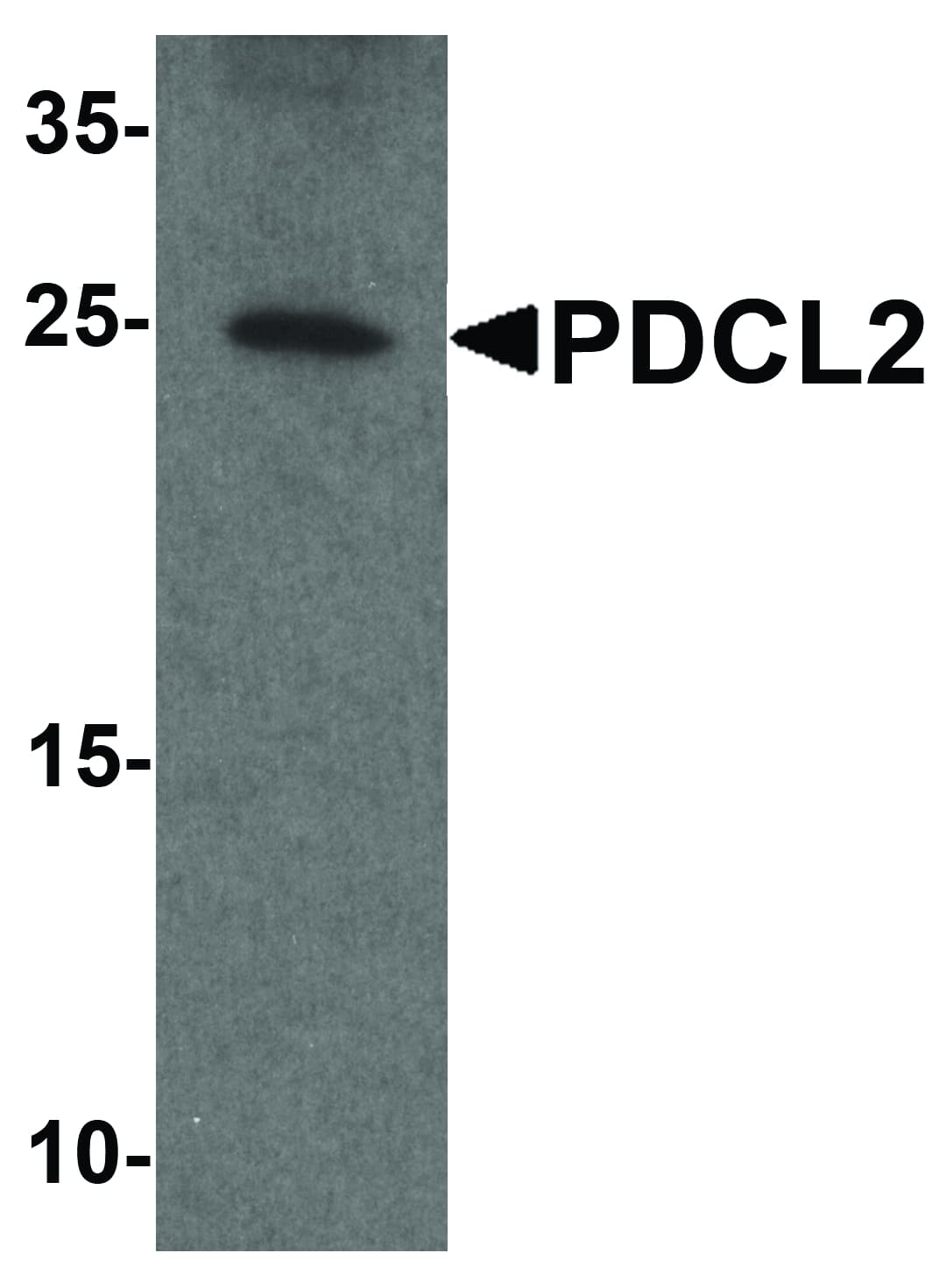 PDCL2 Antibody