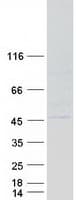 Human YKL39 / CHI3L2 Protein (Recombinant Myc-DDK (Flag))
