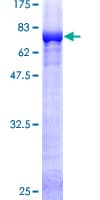 Human GSS / Glutathione Synthetase Protein (Recombinant GST)