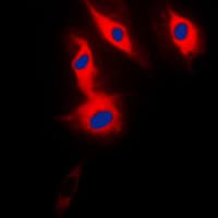 SP32 / ACRBP Antibody (Internal)