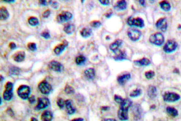 Polyclonal Rabbit anti-Human IGF1R / IGF1 Receptor Antibody (phospho-Tyr1161, IHC, WB)
