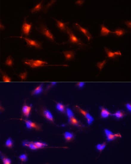 NES / Nestin Antibody