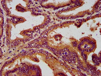 SLC19A2 / TC1 Antibody
