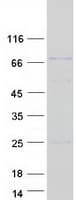 Human SMIF / DCP1A Protein (Recombinant Myc-DDK (Flag))