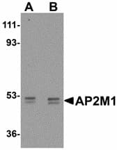 AP50 / AP2M1 Antibody