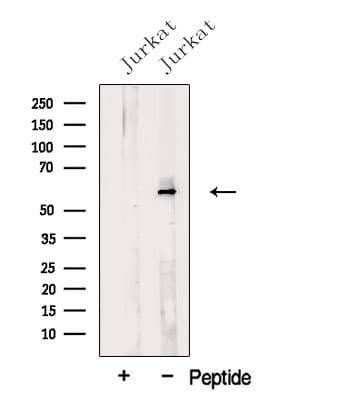 NELFA / WHSC2 Antibody