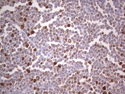 PCNA Antibody (clone OTI13G4)