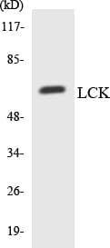 Polyclonal Rabbit anti-Human p56lck / LCK Antibody (aa59-108, WB)