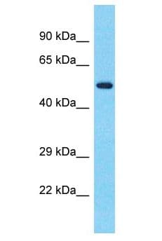 TBKBP1 Antibody (aa116-165)