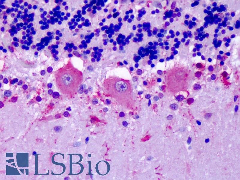 IHC-plus™ OR6N1 Antibody (Extracellular Domain)